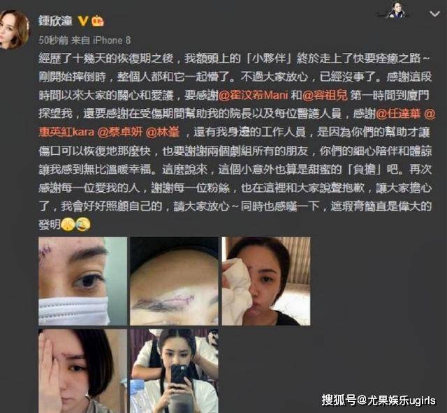 李丽莎顾欣怡露欧洲杯(李丽莎顾欣怡欧洲杯24fa)  第2张